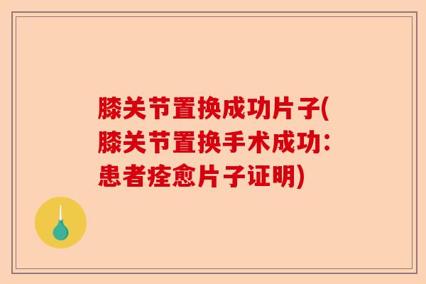 膝关节置换成功片子(膝关节置换手术成功：患者痊愈片子证明)-第1张图片-关节保镖
