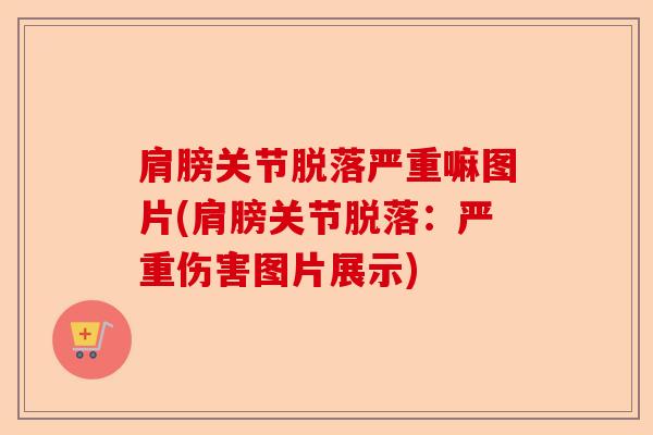 肩膀关节脱落严重嘛图片(肩膀关节脱落：严重伤害图片展示)
