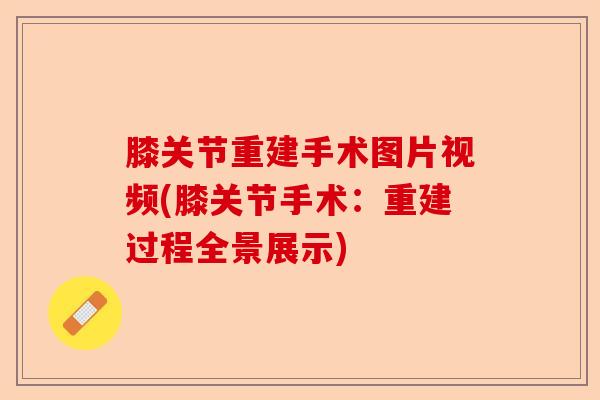 膝关节重建手术图片视频(膝关节手术：重建过程全景展示)-第1张图片-关节保镖