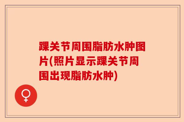 踝关节周围脂肪水肿图片(照片显示踝关节周围出现脂肪水肿)-第1张图片-关节保镖