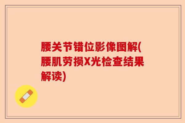 腰关节错位影像图解(腰肌劳损X光检查结果解读)-第1张图片-关节保镖