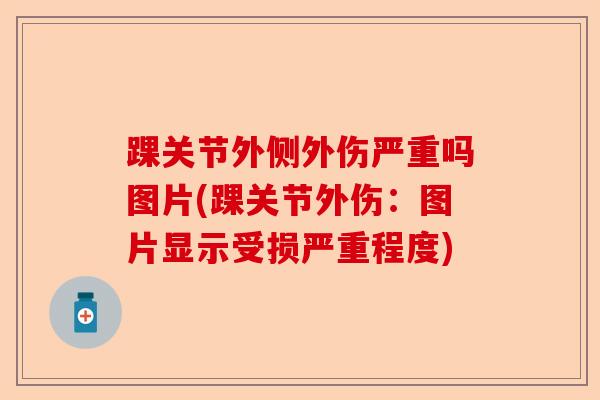 踝关节外侧外伤严重吗图片(踝关节外伤：图片显示受损严重程度)-第1张图片-关节保镖