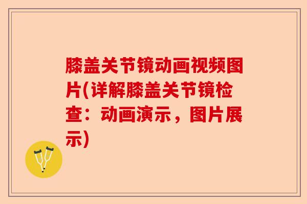 膝盖关节镜动画视频图片(详解膝盖关节镜检查：动画演示，图片展示)-第1张图片-关节保镖