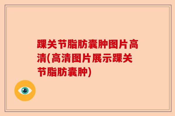 踝关节脂肪囊肿图片高清(高清图片展示踝关节脂肪囊肿)