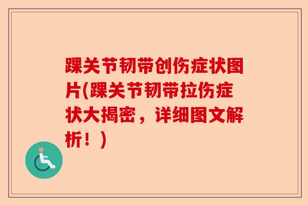 踝关节韧带创伤症状图片(踝关节韧带拉伤症状大揭密，详细图文解析！)