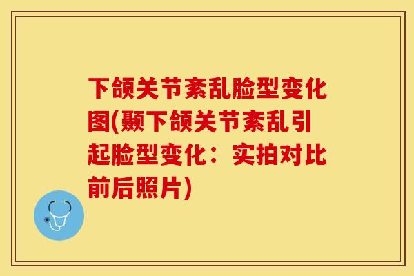 下颌关节紊乱脸型变化图(颞下颌关节紊乱引起脸型变化：实拍对比前后照片)