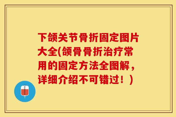 下颌关节骨折固定图片大全(颌骨骨折治疗常用的固定方法全图解，详细介绍不可错过！)