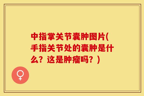 中指掌关节囊肿图片(手指关节处的囊肿是什么？这是肿瘤吗？)
