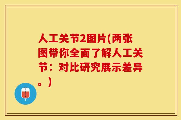 人工关节2图片(两张图带你全面了解人工关节：对比研究展示差异。)