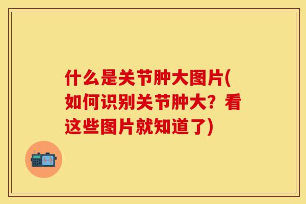 什么是关节肿大图片(如何识别关节肿大？看这些图片就知道了)