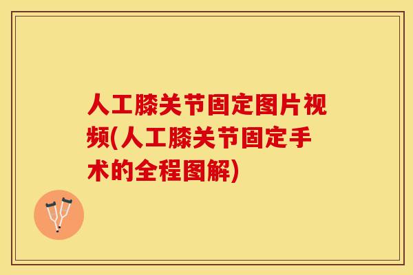 人工膝关节固定图片视频(人工膝关节固定手术的全程图解)