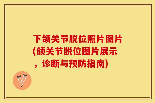 下颌关节脱位照片图片(颌关节脱位图片展示，诊断与预防指南)