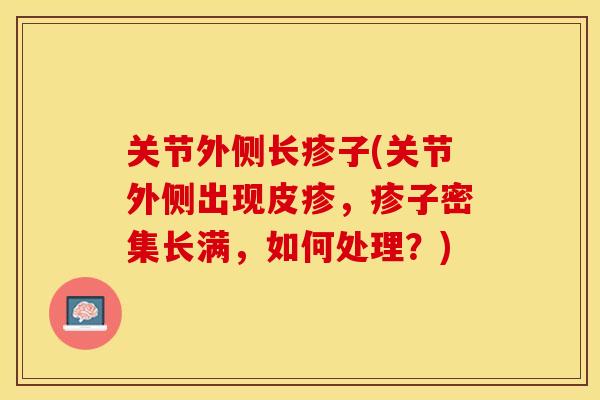 关节外侧长疹子(关节外侧出现皮疹，疹子密集长满，如何处理？)