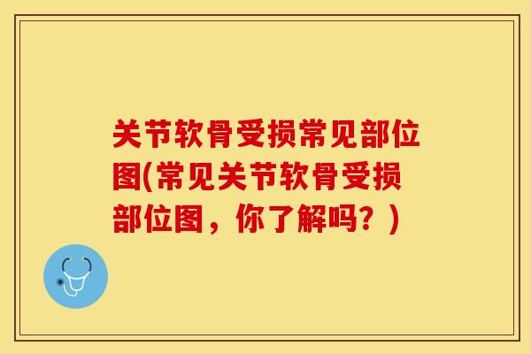 关节软骨受损常见部位图(常见关节软骨受损部位图，你了解吗？)