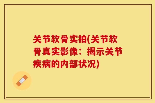 关节软骨实拍(关节软骨真实影像：揭示关节疾病的内部状况)-第1张图片-关节保镖