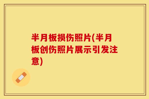 半月板损伤照片(半月板创伤照片展示引发注意)-第1张图片-关节保镖