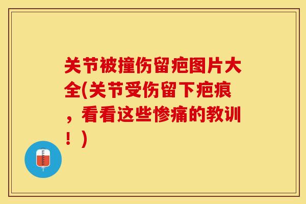 关节被撞伤留疤图片大全(关节受伤留下疤痕，看看这些惨痛的教训！)