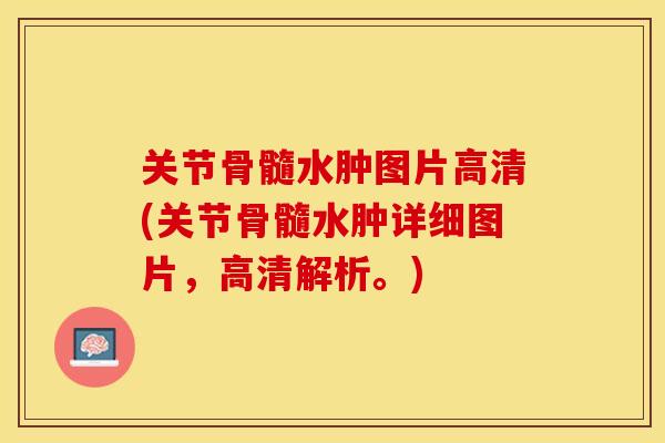 关节骨髓水肿图片高清(关节骨髓水肿详细图片，高清解析。)