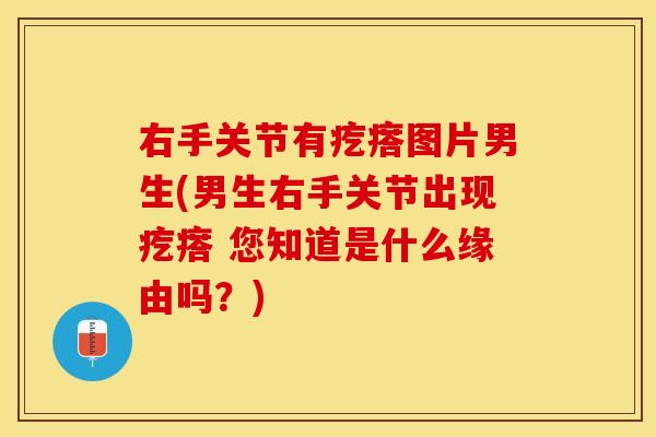 右手关节有疙瘩图片男生(男生右手关节出现疙瘩 您知道是什么缘由吗？)