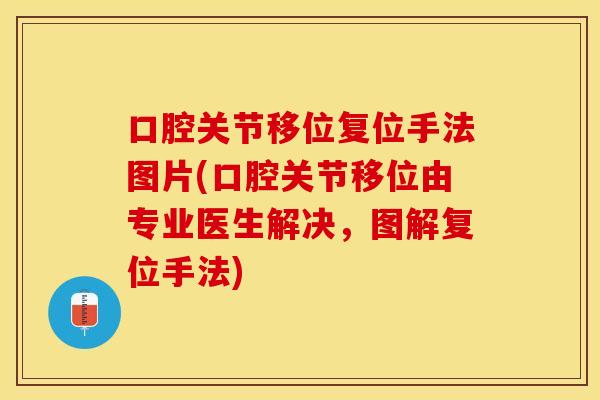 口腔关节移位复位手法图片(口腔关节移位由专业医生解决，图解复位手法)