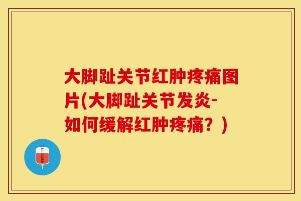 大脚趾关节红肿疼痛图片(大脚趾关节发炎-如何缓解红肿疼痛？)