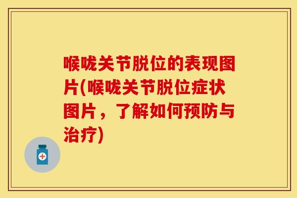 喉咙关节脱位的表现图片(喉咙关节脱位症状图片，了解如何预防与治疗)