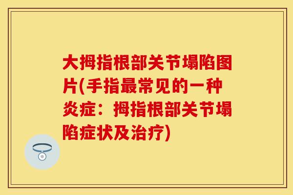 大拇指根部关节塌陷图片(手指最常见的一种炎症：拇指根部关节塌陷症状及治疗)