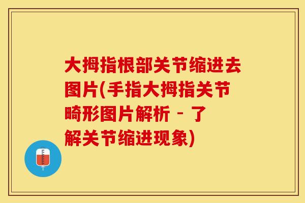 大拇指根部关节缩进去图片(手指大拇指关节畸形图片解析 - 了解关节缩进现象)
