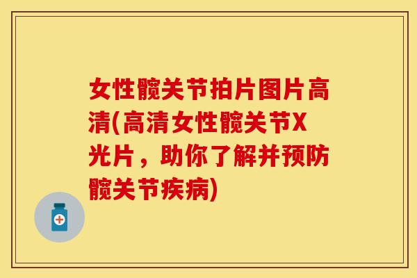 女性髋关节拍片图片高清(高清女性髋关节X光片，助你了解并预防髋关节疾病)