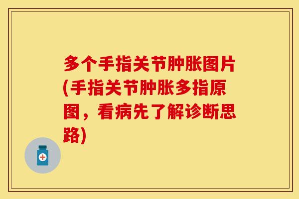 多个手指关节肿胀图片(手指关节肿胀多指原图，看病先了解诊断思路)