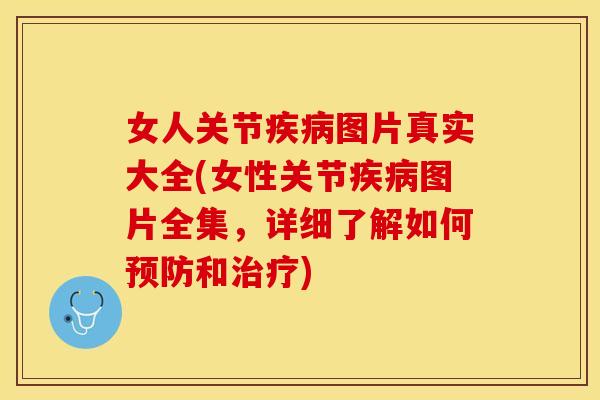 女人关节疾病图片真实大全(女性关节疾病图片全集，详细了解如何预防和治疗)