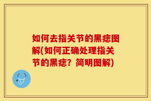 如何去指关节的黑痣图解(如何正确处理指关节的黑痣？简明图解)