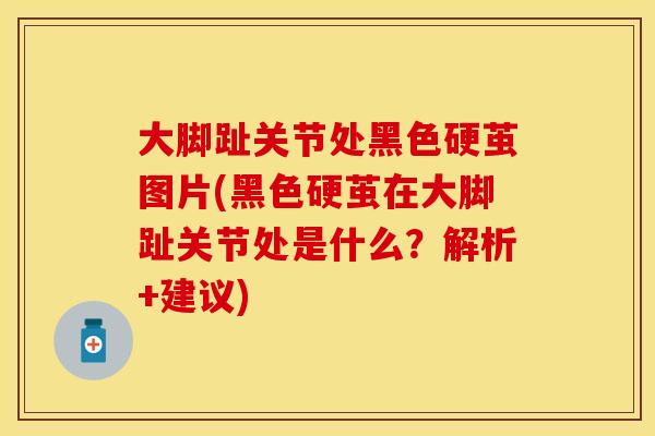 大脚趾关节处黑色硬茧图片(黑色硬茧在大脚趾关节处是什么？解析+建议)