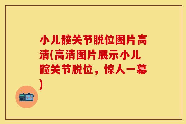 小儿髋关节脱位图片高清(高清图片展示小儿髋关节脱位，惊人一幕)