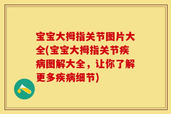 宝宝大拇指关节图片大全(宝宝大拇指关节疾病图解大全，让你了解更多疾病细节)