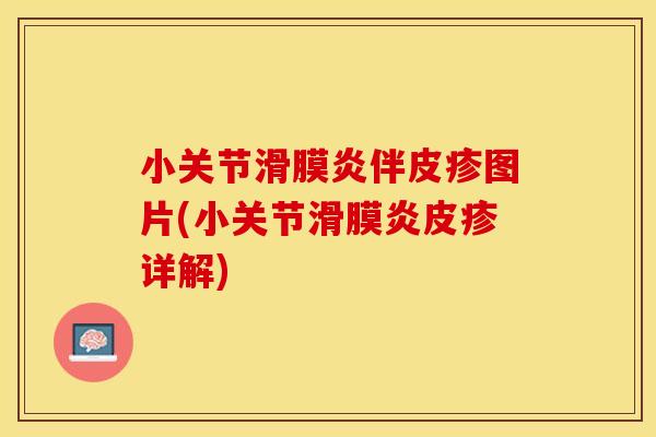 小关节滑膜炎伴皮疹图片(小关节滑膜炎皮疹详解)