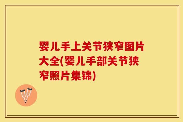婴儿手上关节狭窄图片大全(婴儿手部关节狭窄照片集锦)-第1张图片-关节保镖 婴儿手上关节狭窄图片大全(婴儿手部关节狭窄照片集锦)-第1张图片-关节保镖