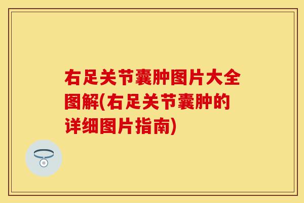 右足关节囊肿图片大全图解(右足关节囊肿的详细图片指南)