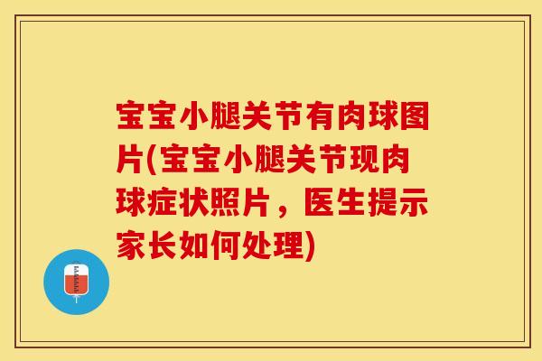 宝宝小腿关节有肉球图片(宝宝小腿关节现肉球症状照片，医生提示家长如何处理)