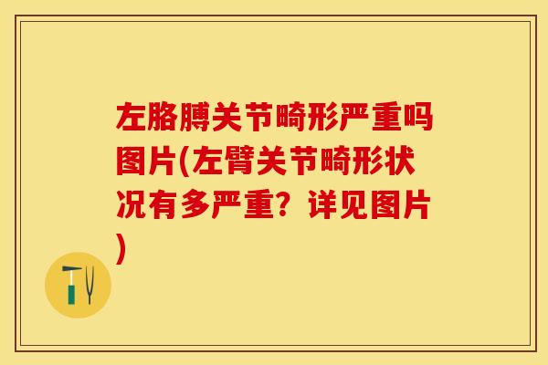 左胳膊关节畸形严重吗图片(左臂关节畸形状况有多严重？详见图片)