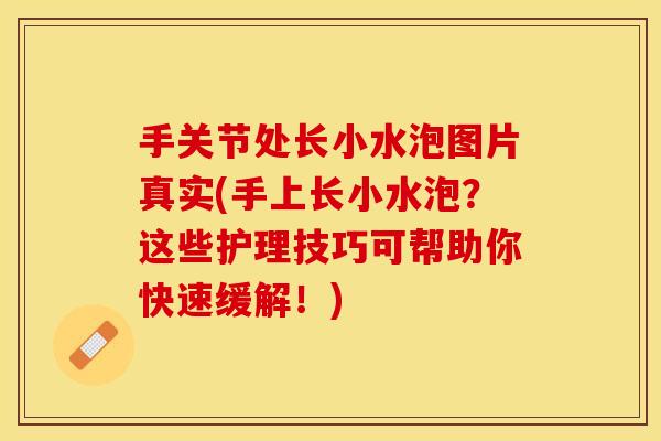 手关节处长小水泡图片真实(手上长小水泡？这些护理技巧可帮助你快速缓解！)