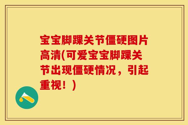 宝宝脚踝关节僵硬图片高清(可爱宝宝脚踝关节出现僵硬情况，引起重视！)-第1张图片-关节保镖