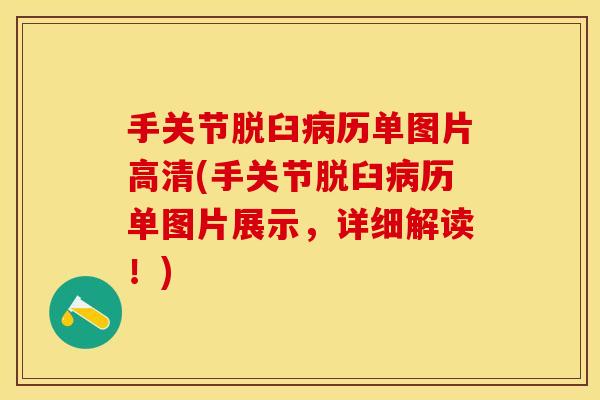 手关节脱臼病历单图片高清(手关节脱臼病历单图片展示，详细解读！)
