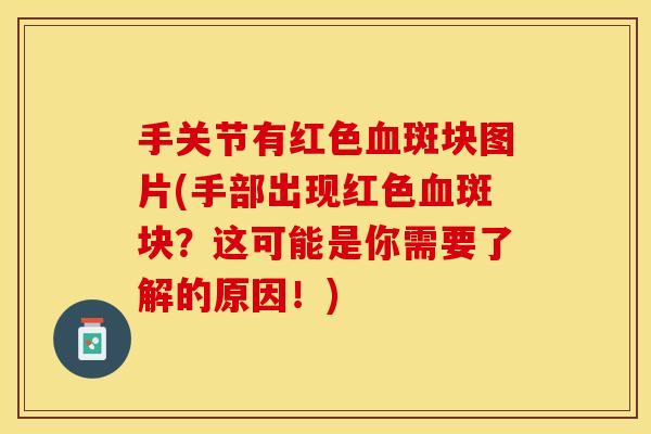 手关节有红色血斑块图片(手部出现红色血斑块？这可能是你需要了解的原因！)