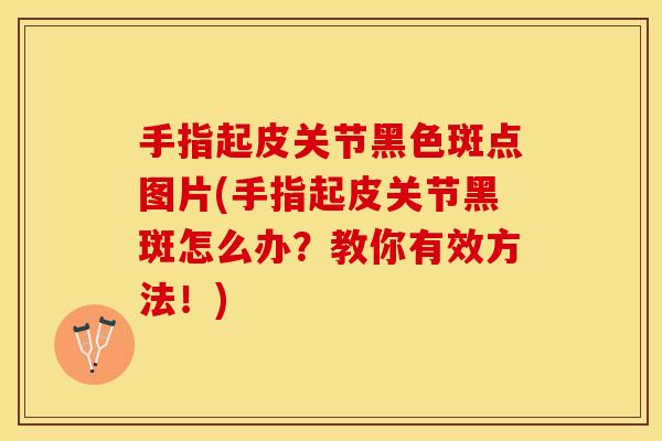 手指起皮关节黑色斑点图片(手指起皮关节黑斑怎么办？教你有效方法！)-第1张图片-关节保镖