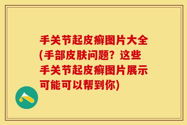 手关节起皮癣图片大全(手部皮肤问题？这些手关节起皮癣图片展示可能可以帮到你)