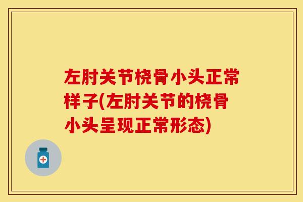 左肘关节桡骨小头正常样子(左肘关节的桡骨小头呈现正常形态)-第1张图片-关节保镖 左肘关节桡骨小头正常样子(左肘关节的桡骨小头呈现正常形态)-第1张图片-关节保镖