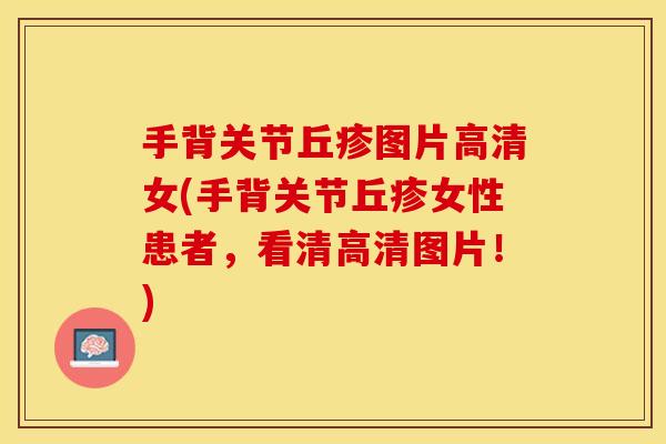 手背关节丘疹图片高清女(手背关节丘疹女性患者，看清高清图片！)
