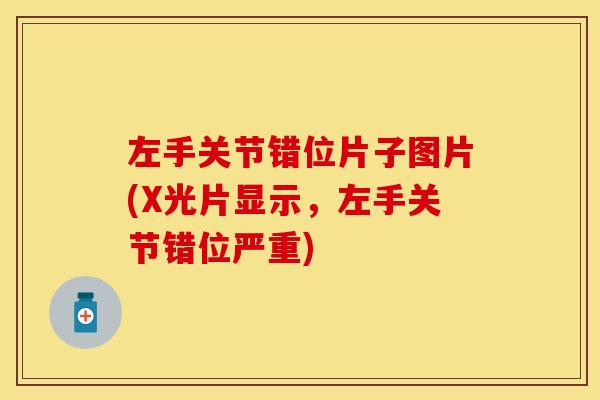 左手关节错位片子图片(X光片显示，左手关节错位严重)