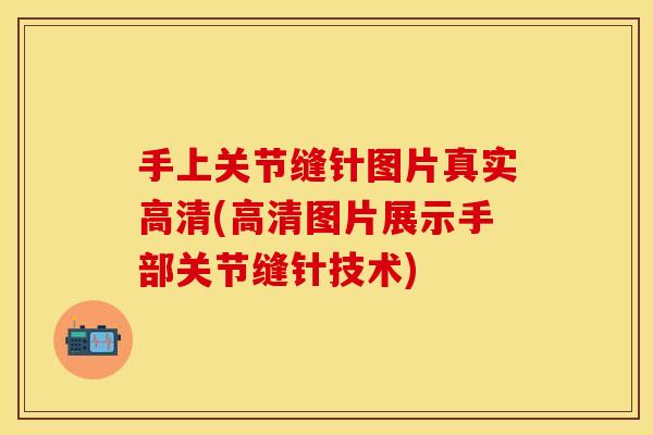 手上关节缝针图片真实高清(高清图片展示手部关节缝针技术)